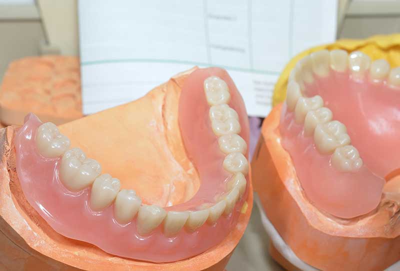 kelowna denturist near me
